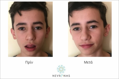 stoma-anoixto-kleisto